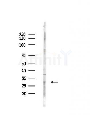 Cytochrome b561 Antibody - Western blot analysis of lysates from HepG2 cells(heat-shock,45min treatment), using Cytochrome b561 Antibody at 1/1000 dilution.