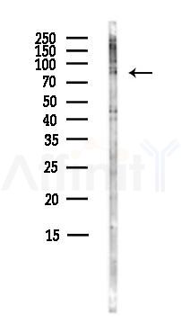 HJURP Antibody - Western blot analysis of lysates from HepG2 cells(heat-shock,45min treatment), using HJURP Antibody at 1/1000 dilution.