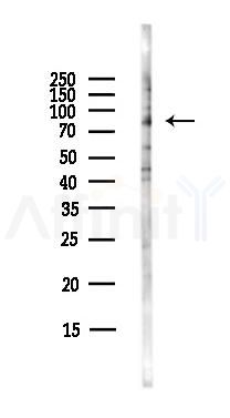 HJURP Antibody - Western blot analysis of lysates from Hela cells(starvation,24h treatment), using HJURP Antibody at 1/1000 dilution.