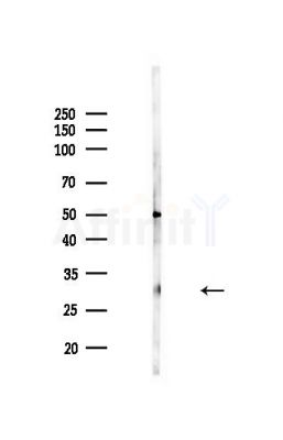 IGFBP6 Antibody - Western blot analysis of lysates from MDA-MB-231 cells(heat-shock,45min treatment), using IGFBP6 Antibody at 1/1000 dilution.