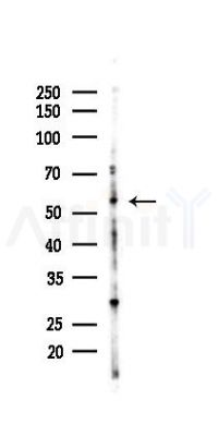 IFIT2 Antibody - Western blot analysis of lysates from HepG2 cells(heat-shock,45min treatment), using IFIT2 Antibody at 1/1000 dilution.