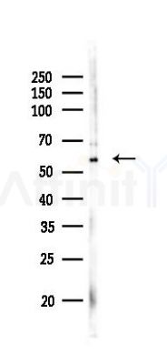IFIT2 Antibody - Western blot analysis of lysates from COLO205 cells(LPS,4h treatment), using IFIT2 Antibody at 1/1000 dilution.