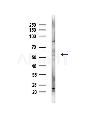 IFRD2 Antibody - Western blot analysis of lysates from HepG2 cells(heat-shock,45min treatment), using IFRD2 Antibody at 1/1000 dilution.