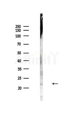 IGFL3 Antibody - Western blot analysis of lysates from Mouse lung, using IGFL3 Antibody at 1/1000 dilution.