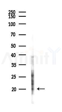 IL26 Antibody - Western blot analysis of lysates from Hela cells(starvation,24h treatment), using IL26 Antibody at 1/1000 dilution.