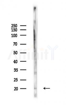 IL3 Antibody - Western blot analysis of lysates from 293 cells(heat-shock,45min treatment), using IL3 Antibody at 1/1000 dilution.