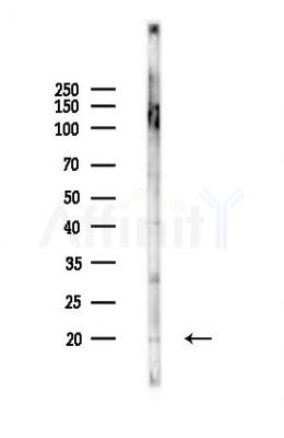 IL3 Antibody - Western blot analysis of lysates from K562 cells(UV,30min treatment), using IL3 Antibody at 1/1000 dilution.