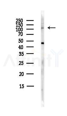ITGA8 Antibody - Western blot analysis of lysates from HepG2 cells(heat-shock,45min treatment), using ITGA8 Antibody at 1/1000 dilution.