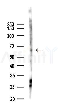 K2C3 Antibody - Western blot analysis of lysates from Hela cells(starvation,24h treatment), using K2C3 Antibody at 1/1000 dilution.