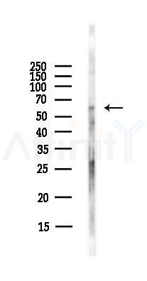 Cytokeratin 6 Antibody - Western blot analysis of lysates from Hela cells(starvation,24h treatment), using Cytokeratin 6 Antibody at 1/1000 dilution.