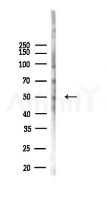 KRT81 Antibody - Western blot analysis of lysates from 293 cells(heat-shock,45min treatment), using KRT81 Antibody at 1/1000 dilution.