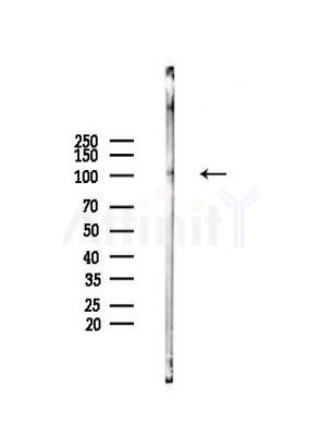 MAGE1 Antibody - Western blot analysis of lysates from Hela cells(heat-shock,45min treatment), using MAGE1 Antibody at 1/1000 dilution.