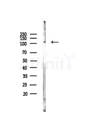 MAGE1 Antibody - Western blot analysis of lysates from COLO205 cells, using MAGE1 Antibody at 1/1000 dilution.