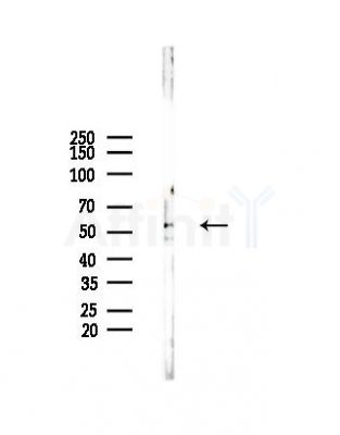 ALPPL2 Antibody - Western blot analysis of lysates from Hela cells(heat-shock,45min treatment), using ALPPL2 Antibody at 1/1000 dilution.