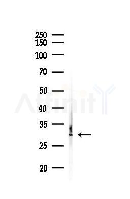 CENPH Antibody - Western blot analysis of lysates from EC304 cells(UV,30min treatment), using CENPH Antibody at 1/1000 dilution.