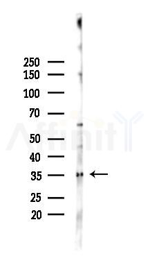 CENPK Antibody - Western blot analysis of lysates from RAW264.