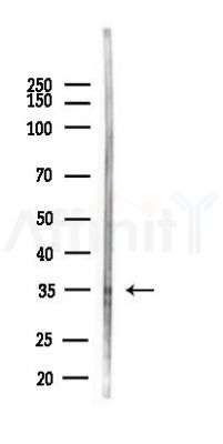 HUS1B Antibody - Western blot analysis of lysates from Rat lung, using HUS1B Antibody at 1/1000 dilution.