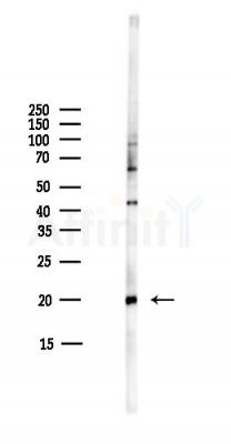 RPS10 Antibody - Western blot analysis of lysates from COLO205 cells(heat-shock,45min treatment), using RPS10 Antibody at 1/1000 dilution.