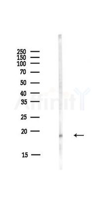 RPS10 Antibody - Western blot analysis of lysates from HUVEC cells(starvation,24h treatment), using RPS10 Antibody at 1/1000 dilution.