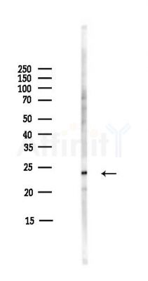 RPL13A Antibody - Western blot analysis of lysates from COLO205 cells(heat-shock,45min treatment), using RPL13A Antibody at 1/1000 dilution.