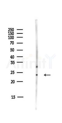 RPL13A Antibody - Western blot analysis of lysates from HUVEC cells(starvation,24h treatment), using RPL13A Antibody at 1/1000 dilution.