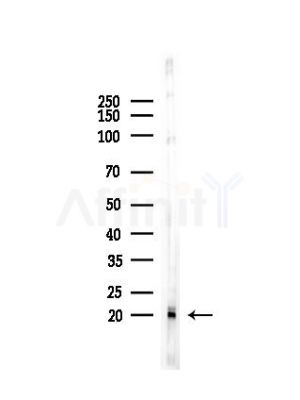 RPL29 Antibody - Western blot analysis of lysates from HUVEC cells(LPS, 4h treatment), using RPL29 Antibody at 1/1000 dilution.