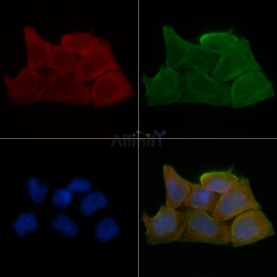 ACAD11 Antibody - DF9147 staining Hela cells(30min of UV treatment) by IF/ICC.