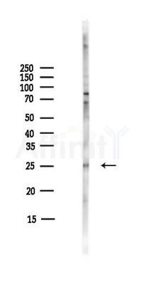 ACBD4 Antibody - Western blot analysis of lysates from COLO205 cells(heat-shock,45min treatment), using ACBD4 Antibody at 1/1000 dilution.
