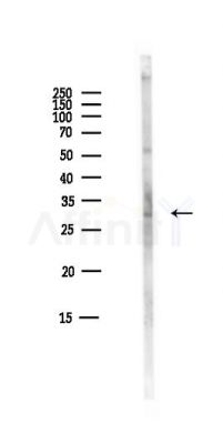 ACBD4 Antibody - Western blot analysis of lysates from Mouse liver, using ACBD4 Antibody at 1/1000 dilution.