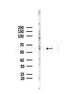 ACBD5 Antibody - Western blot analysis of lysates from A375 cells(heat-shock,45min treatment), using ACBD5 Antibody at 1/1000 dilution.