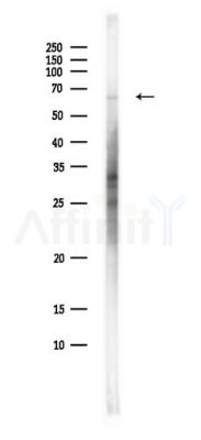 ACOX3 Antibody - Western blot analysis of lysates from Hela cells(starvation,24h treatment), using ACOX3 Antibody at 1/1000 dilution.