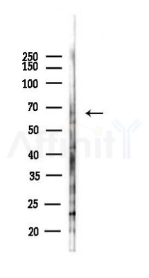 AOAH Antibody - Western blot analysis of lysates from 293 cells(heat-shock,45min treatment), using AOAH Antibody at 1/1000 dilution.