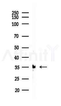 ADAM28 Antibody - Western blot analysis of lysates from Mouse liver, using ADAM28 Antibody at 1/1000 dilution.