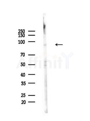 ADAM30 Antibody - Western blot analysis of lysates from Hela cells(heat-shock,45min treatment), using ADAM30 Antibody at 1/1000 dilution.