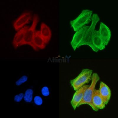 ADAMTS2 Antibody - DF9175 staining Hela cells(30min of UV treatment) by IF/ICC.