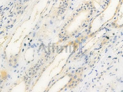 ADAMTS7 Antibody - DF9177 at 1/100 staining human normal kidney tissue by IHC-P.