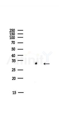 SLC25A5 Antibody - Western blot analysis of lysates from HUVEC cells(starvation,24h treatment), using SLC25A5 Antibody at 1/1000 dilution.