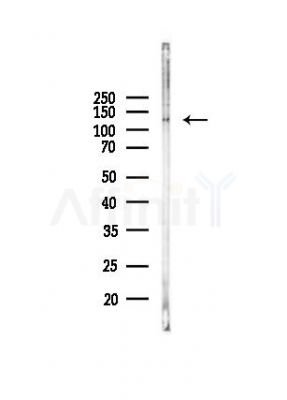 AFF4 Antibody - Western blot analysis of lysates from PC12 cells(UV, 30min treatment), using AFF4 Antibody at 1/1000 dilution.