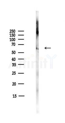 AAAS Antibody - Western blot analysis of lysates from COLO205 cells(heat-shock,45min treatment), using AAAS Antibody at 1/1000 dilution.
