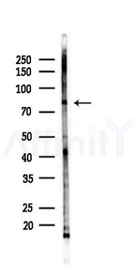 SCNN1A Antibody - Western blot analysis of lysates from HepG2 cells(heat-shock,45min treatment), using SCNN1A Antibody at 1/1000 dilution.
