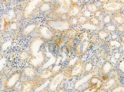 AAMP Antibody - DF9207 at 1/100 staining human normal kidney tissue by IHC-P.