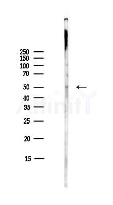 ANGPTL1 Antibody - Western blot analysis of lysates from COLO205 cells(heat-shock,45min treatment), using ANGPTL1 Antibody at 1/1000 dilution.