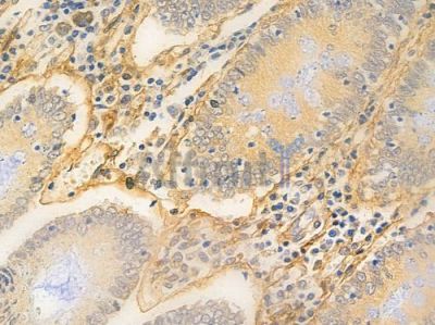 ANGPTL1 Antibody - DF9210 at 1/100 staining human normal colon tissue by IHC-P.