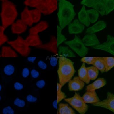 SLC4A3 Antibody - DF9213 staining Hela cells by IF/ICC.