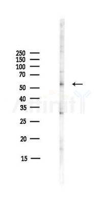 ANXA11 Antibody - Western blot analysis of lysates from COLO205 cells(heat-shock,45min treatment), using ANXA11 Antibody at 1/1000 dilution.