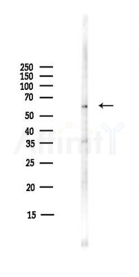 ARSB Antibody - Western blot analysis of lysates from COLO205 cells(heat-shock,45min treatment), using ARSB Antibody at 1/1000 dilution.
