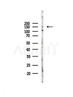 ABCC11 Antibody - Western blot analysis of lysates from PC12 cells(UV, 30min treatment), using ABCC11 Antibody at 1/1000 dilution.