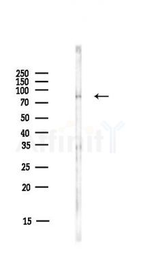 AXIN1 Antibody - Western blot analysis of lysates from HUVEC cells(starvation,24h treatment), using AXIN1 Antibody at 1/1000 dilution.