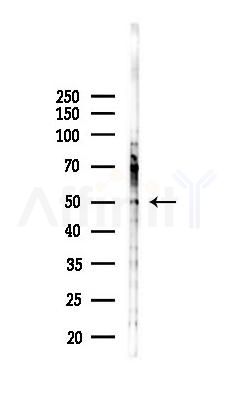 GCNT4 Antibody - Western blot analysis of lysates from Hela cells(starvation,24h treatment), using GCNT4 Antibody at 1/1000 dilution.