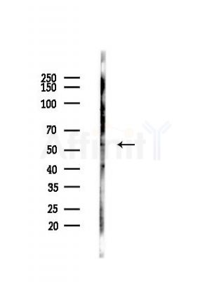 SLC22A17 Antibody - Western blot analysis of lysates from HepG2 cells(heat-shock,45min treatment), using SLC22A17 Antibody at 1/1000 dilution.